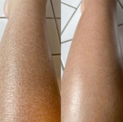 Lustelva™ Exfoliating Glove (Pack of 2)