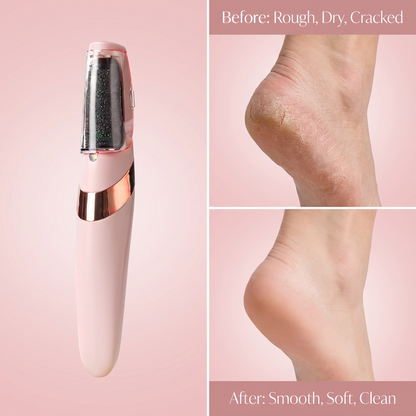 Electric Foot Callus Remover