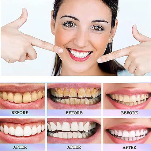 Oralhoe Dazzle White Toothpaste