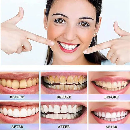 Oralhoe Dazzle White Toothpaste